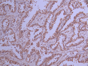 CDKN1C Antibody