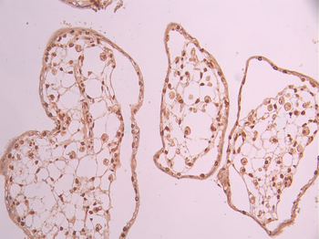 CDKN1C Antibody