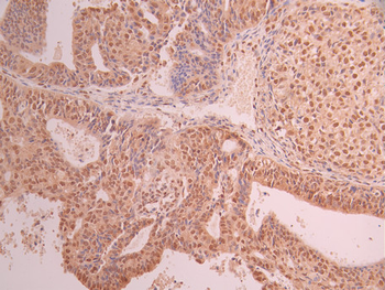 NOX4 Antibody