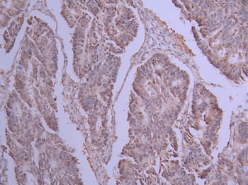 CBFB Antibody