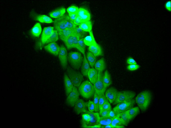 CBFB Antibody