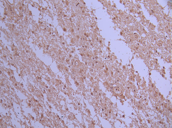 SUN1 Antibody