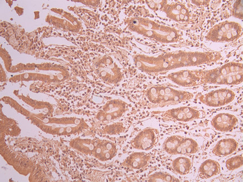 SUN1 Antibody