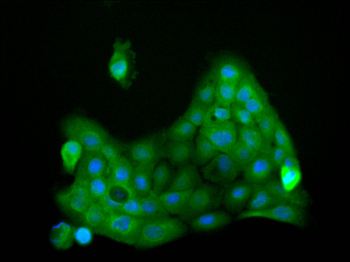 SUN1 Antibody