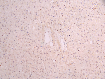 SUN2 Antibody