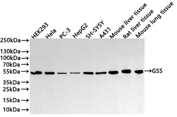 GSS Antibody