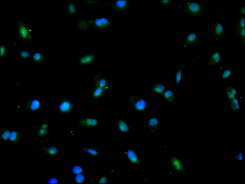 GSS Antibody