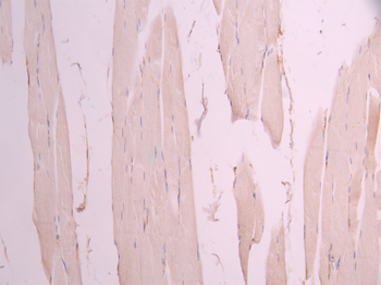 ACTA2&ACTC1&ACTG2 Antibody