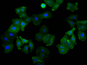 ACTA2&ACTC1&ACTG2 Antibody