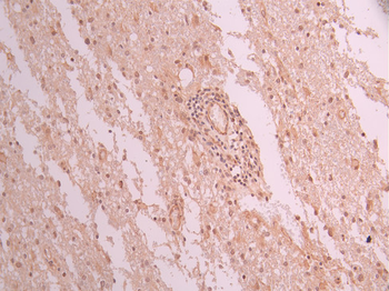 CTBP1 Antibody