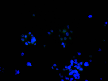 CTBP1 Antibody