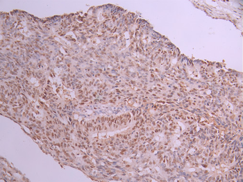 MCM3 Antibody