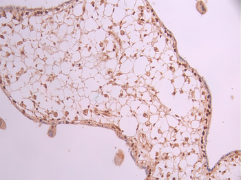 MCM3 Antibody