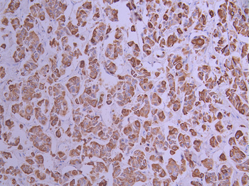 KRT19 Antibody