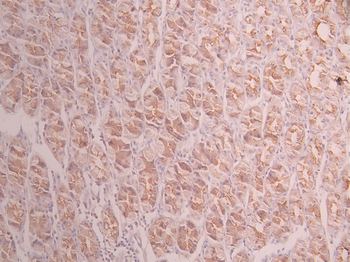 KRT19 Antibody