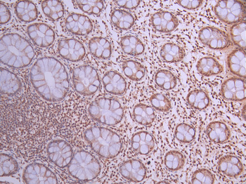 ACTL6A Antibody