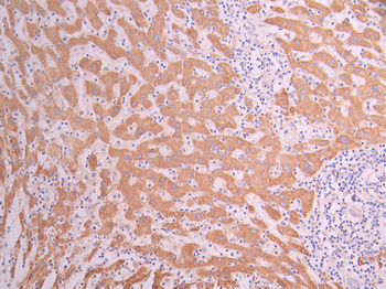 CYP27A1 Antibody