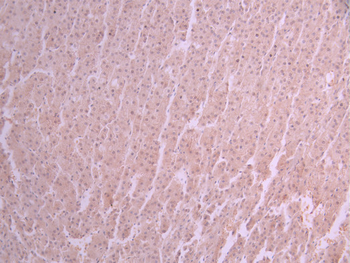 CYP27A1 Antibody