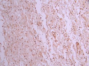 NXF1 Antibody