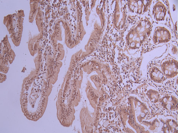 NXF1 Antibody