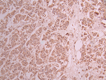 XPO5 Antibody