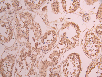 XPO5 Antibody