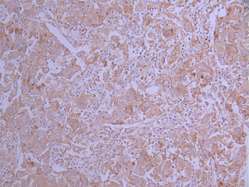 SCARB1 Antibody