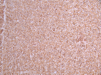 SCARB1 Antibody