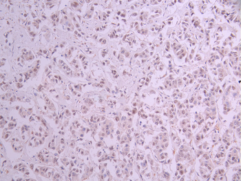 SMARCE1 Antibody