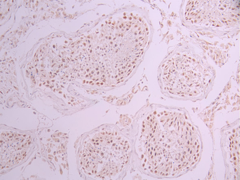 SMARCE1 Antibody