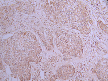 PSENEN Antibody