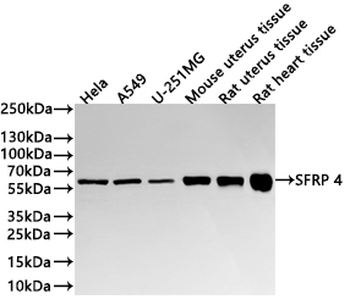 SFRP4 Antibody