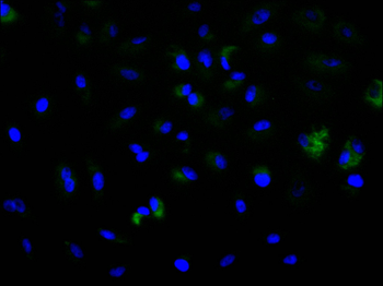 SFRP4 Antibody