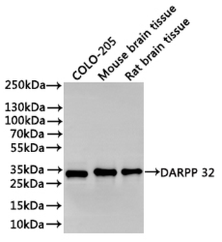 PPP1R1B Antibody