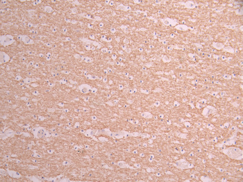 PPP1R1B Antibody