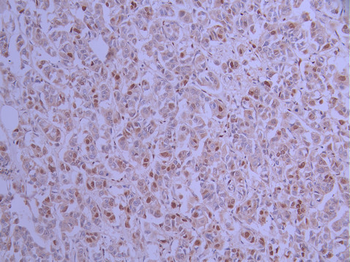 KHSRP Antibody