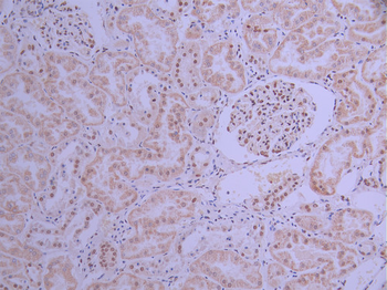 KHSRP Antibody