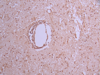 TCL1A Antibody