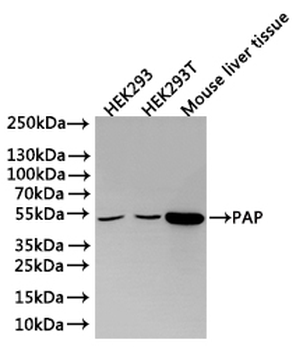 ACPP Antibody