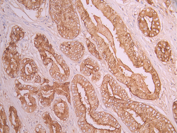 ACPP Antibody