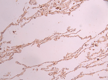 BBC3 Antibody