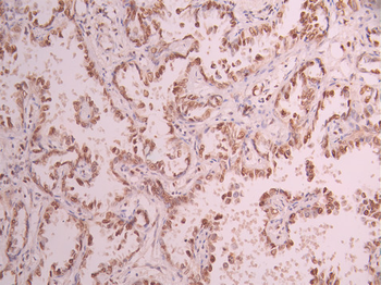 PBRM1 Antibody