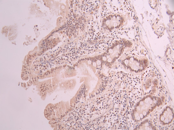 PBRM1 Antibody