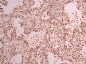 SRSF3 Antibody