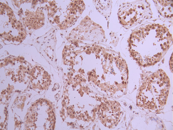 SRSF3 Antibody