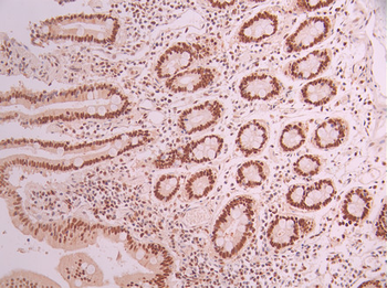 POLD1 Antibody