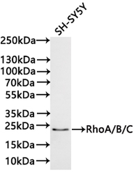 RHOB&RHOA&RHOC Antibody