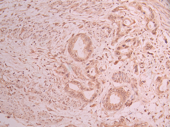 DLX5 Antibody