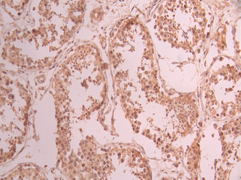 DLX5 Antibody