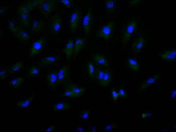 BMP6 Antibody